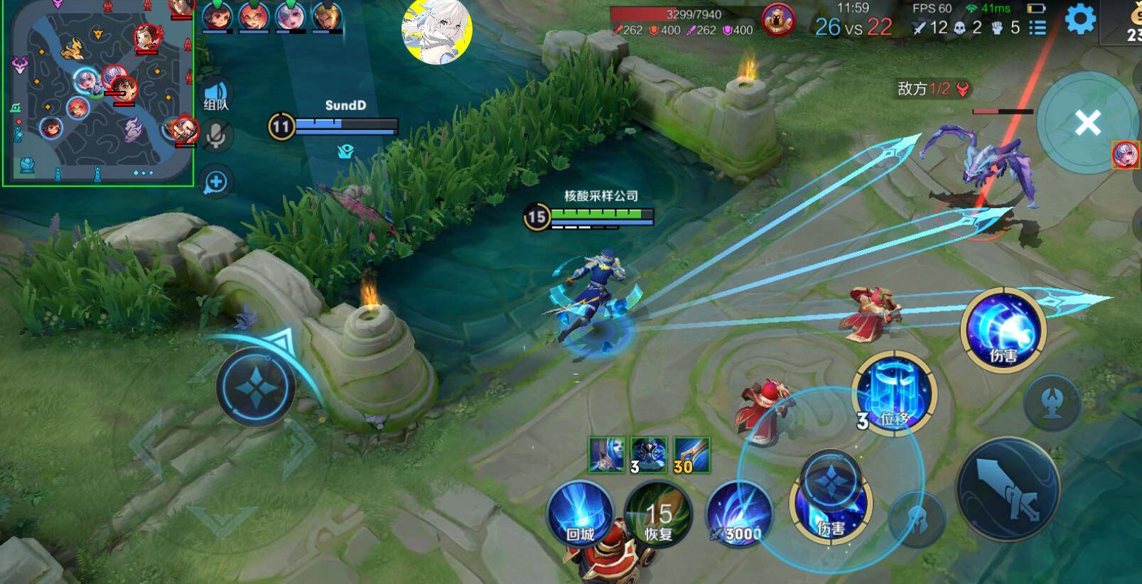 如何选择适合自己的王者荣耀辅助？